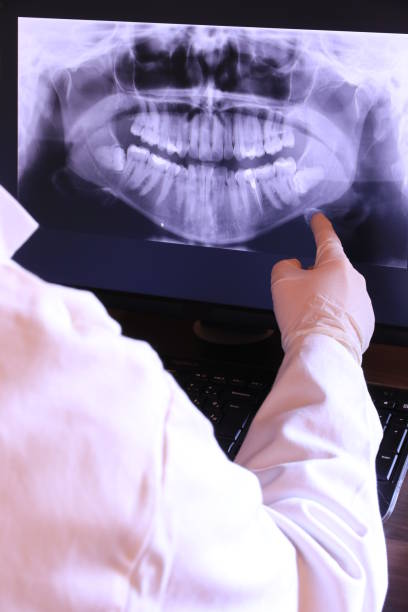 Best Emergency Root Canal Therapy in Manton, MI