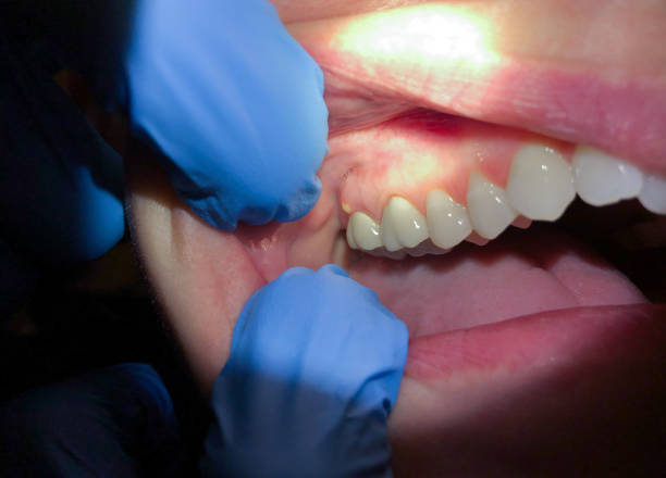 Best Emergency Orthodontic Repairs in Manton, MI