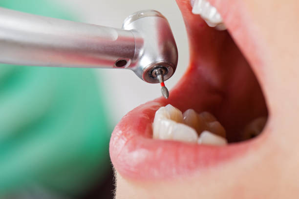 Best Weekend Emergency Dental Services in Manton, MI
